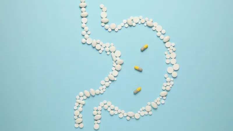 Chuyên gia y tế tư vấn lựa chọn thuốc tây chữa viêm loét dạ dày