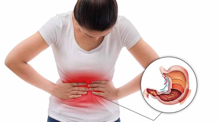 Viêm Loét Dạ Dày Tiếng Anh Là Gì? Toàn Diện Từ A Đến Z Viêm Loét Dạ Dày Tiếng Anh Là Gì? Toàn Diện Từ A Đến Z